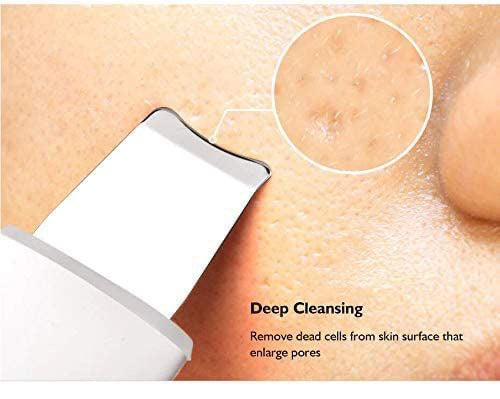 Ultrasonic Facial Skin Scrubber – Deep Pore Cleanser & Blackhead Remover | Lifting & Hydrating Beauty Device