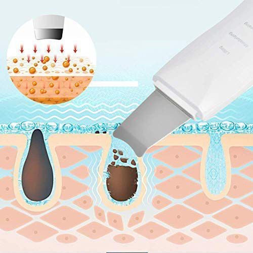 Ultrasonic Facial Skin Scrubber – Deep Pore Cleanser & Blackhead Remover | Lifting & Hydrating Beauty Device